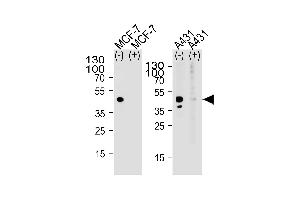 Western blot analysis of lysate from MCF-7, A431 cell line, using CALCR Antibody with(+) or without(-) peptides at 1:1000 at each lane. (MICU1 anticorps  (C-Term))