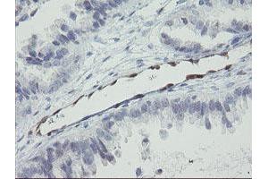 Image no. 5 for anti-RNA Binding Protein with Multiple Splicing (RBPMS) antibody (ABIN1500642)