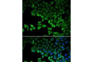 Immunofluorescence analysis of HeLa cells using RIG-I / DDX58 Polyclonal Antibody (DDX58 anticorps)