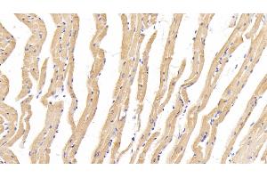 Detection of MYH1 in Mouse Cardiac Muscle Tissue using Polyclonal Antibody to Myosin Heavy Chain 1 (MYH1)