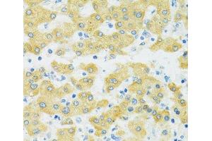 Immunohistochemistry of paraffin-embedded Human liver using SLC37A4 Polyclonal Antibody at dilution of 1:100 (40x lens).