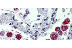 IHC Information:  Lung, Human: Formalin-Fixed, Paraffin-Embedded (FFPE) (CYBB anticorps  (C-Term))