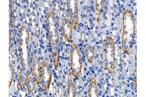 ABIN6262627 and ABIN6268688 at 1/100 staining Rat kidney tissue by IHC-P.