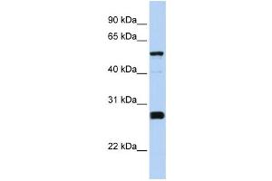 Western Blotting (WB) image for anti-Family with Sequence Similarity 83, Member F (FAM83F) antibody (ABIN2459545) (FAM83F anticorps)