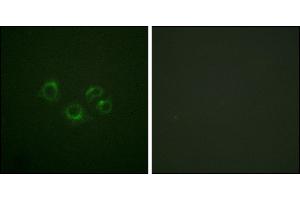 Immunofluorescence analysis of A549 cells, using EPHA2/3/4 (Ab-588/596) antibody. (EPHA2/3/4 anticorps)