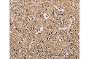 Immunohistochemistry of Human brain  using PIP4K2A Polyclonal Antibody at dilution of 1:50 (PIP4K2A anticorps)