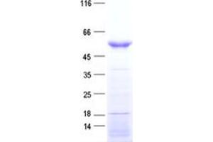 Validation with Western Blot (HORMAD1 Protein (His tag))