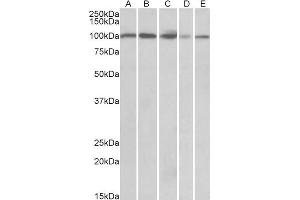 ABIN768646 (0. (SIDT1 anticorps  (AA 334-347))