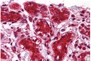 Human Breast: Formalin-Fixed, Paraffin-Embedded (FFPE) (CLIC1 anticorps  (AA 1-242))