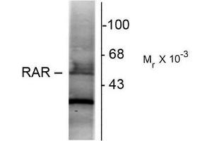 Western Blotting (WB) image for anti-Retinoic Acid Receptor, alpha (RARA) (N-Term) antibody (ABIN371837)