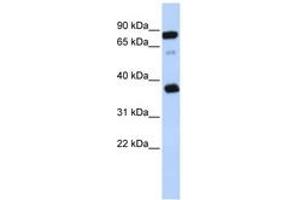 Image no. 1 for anti-B-Cell Receptor-Associated Protein 29 (BCAP29) (AA 209-258) antibody (ABIN6743315) (BCAP29 anticorps  (AA 209-258))