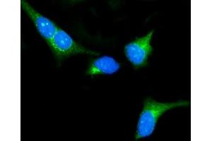 IF analysis of PKA R2/PKR2/PRKAR2A using anti-PKA R2/PKR2/PRKAR2A antibody (ABIN7600543).