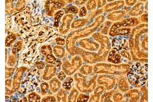 ABIN6266340 and ABIN6276846 at 1/100 staining Mouse kidney tissue by IHC-P.