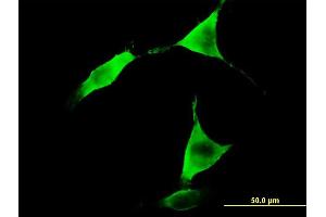 Immunofluorescence of monoclonal antibody to ALDH1L1 on NIH/3T3 cell. (ALDH1L1 anticorps  (AA 803-902))