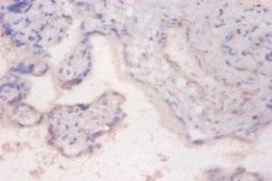 Immunohistochemistry of paraffin-embedded human placenta tissue using ABIN7168200 at dilution of 1:100 (RPS6KB2 anticorps  (AA 1-210))
