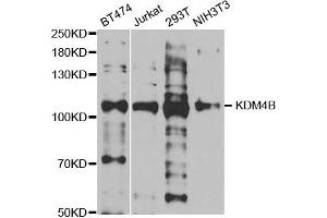 Western blot analysis of extracts of various cell lines, using KDM4B antibody. (KDM4B anticorps)