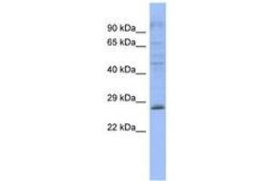 Image no. 1 for anti-Pleckstrin Homology Domain Containing, Family B (Evectins) Member 2 (PLEKHB2) (AA 143-192) antibody (ABIN6743268) (PLEKHB2 anticorps  (AA 143-192))