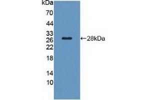 Figure. (TSH receptor anticorps  (AA 28-245))