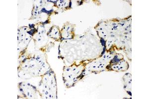 Anti-CYP11A1 antibody, IHC(F): Human Placenta Tissue