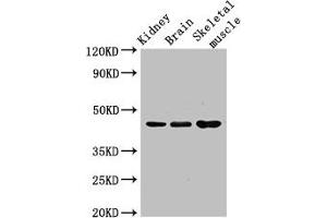 Caspase 4 anticorps  (AA 82-226)
