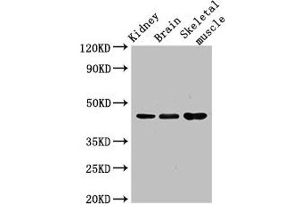 Caspase 4 anticorps  (AA 82-226)