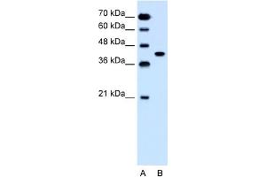 WB Suggested Anti-SLC35B1 Antibody Titration:  1. (SLC35B1 anticorps  (C-Term))