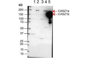 Western Blot of Anti-CASZ1 Antibody.