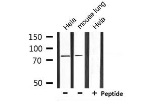 Western blot analysis of extracts from Hela and mouse lung, using SLC9A7 Antibody. (NHE7 anticorps  (Internal Region))