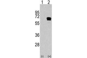 Western blot analysis of CAMKK2 antibody and 293 cell lysate either nontransfected (Lane 1) or transiently transfected with the CAMKK2 gene (2). (CAMKK2 anticorps  (AA 483-512))