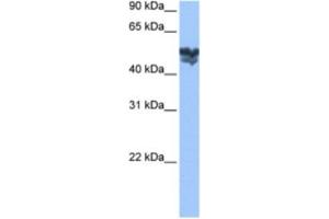 Western Blotting (WB) image for anti-WAS Protein Family, Member 3 (WASF3) antibody (ABIN2463503)