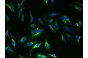 Immunofluorescent analysis of Hela cells using ABIN7172174 at dilution of 1:100 and Alexa Fluor 488-congugated AffiniPure Goat Anti-Rabbit IgG(H+L) (TSH receptor anticorps  (AA 21-413))