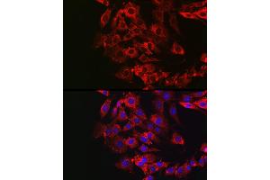 Immunofluorescence analysis of NIH/3T3 cells using GSDME antibody (ABIN6127757, ABIN6139554, ABIN6139555 and ABIN6223304) at dilution of 1:50. (Non-Syndromic Hearing Impairment Protein 5 (GSDME) (AA 1-260) anticorps)