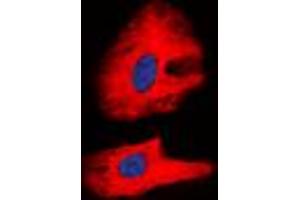 Immunofluorescent analysis of RET (pY1062) staining in K562 cells.