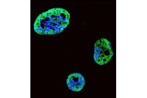 Confocal immunofluorescent analysis of HDGF Antibody (C-term) (ABIN390356 and ABIN2840767) with SK-BR-3 cell followed by Alexa Fluor 488-conjugated goat anti-rabbit lgG (green). (HDGF anticorps  (C-Term))