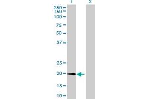 Western Blot analysis of METTL10 expression in transfected 293T cell line by METTL10 MaxPab polyclonal antibody. (METTL10 anticorps  (AA 1-192))