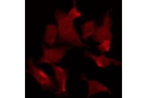 ABIN6275671 staining HT29 by IF/ICC. (Vangl1 anticorps  (Internal Region))