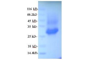 SDS-PAGE (SDS) image for Elastase, Neutrophil Expressed (ELANE) (AA 30-267) protein (His tag) (ABIN5713426)
