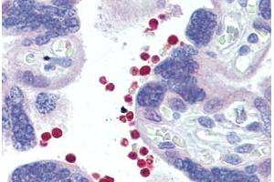 Placenta, red blood cells, Human: Formalin-Fixed, Paraffin-Embedded (FFPE) (AKT1/2 anticorps)