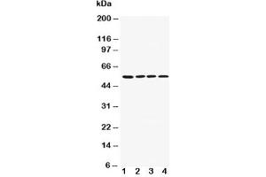 Western blot testing of AChR antibody and Lane 1:  rat brain;  2: mouse brain;  3: U87;  4: SHG-44;  5: Neuro-2a;  6: HeLa cell lysate (CHRM1 anticorps  (AA 303-317))