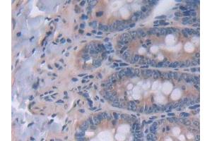 Detection of IL12A in Rat Intestine Tissue using Polyclonal Antibody to Interleukin 12A (IL12A)