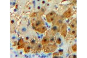Used in DAB staining on fromalin fixed paraffin-embedded Liver tissue