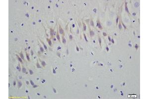 Formalin-fixed and paraffin embedded rat brain labeled with Anti-RGS5 Polyclonal Antibody, Unconjugated (ABIN680803) at 1:200 followed by conjugation to the secondary antibody and DAB staining (RGS5 anticorps  (AA 81-181))