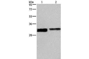 Western Blot analysis of Hela and Jurkat cell using FOSL1 Polyclonal Antibody at dilution of 1:615 (FOSL1 anticorps)