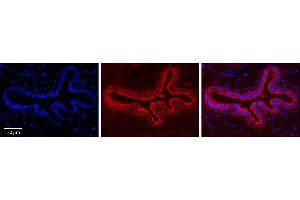 Rabbit Anti-CCT4 Antibody     Formalin Fixed Paraffin Embedded Tissue: Human Bronchial Epithelial Tissue  Observed Staining: Cytoplasmic  Primary Antibody Concentration: 1:100  Secondary Antibody: Donkey anti-Rabbit-Cy3  Secondary Antibody Concentration: 1:200  Magnification: 20X  Exposure Time: 0.