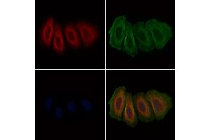ABIN6266217 and ABIN6277375 staining Hela cells by IF/ICC. (GLRA1 anticorps  (Internal Region))