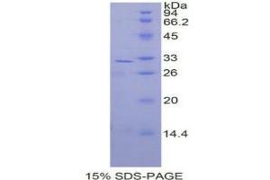 SDS-PAGE analysis of Human MAP2K3 Protein.
