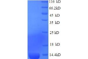 SDS-PAGE (SDS) image for Natriuretic Peptide Receptor B/guanylate Cyclase B (Atrionatriuretic Peptide Receptor B) (NPR2) (AA 22-106) protein (GST tag) (ABIN5709631)