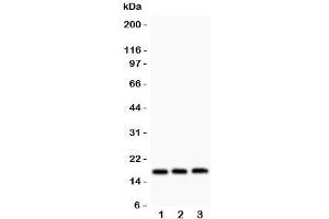 Western blot testing of FHIT antibody and Lane 1:  HT1080;  2: SW620;  3: Jurkat. (FHIT anticorps  (AA 1-147))