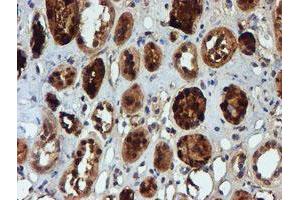 Immunohistochemical staining of paraffin-embedded Human Kidney tissue using anti-NQO2 mouse monoclonal antibody. (NQO2 anticorps)