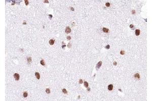 ABIN6272938 at 1/100 staining human brain tissue sections by IHC-P. (BRD7 anticorps  (Internal Region))